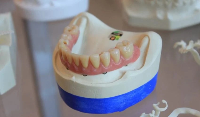 3D打印可以制作更好、更实惠的假牙