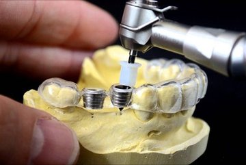 3D打印在牙科行业的技术革命